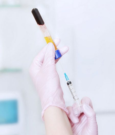 prp-extraction prp-extraction