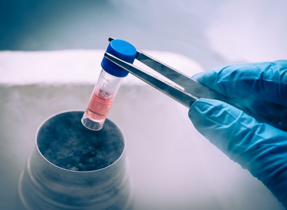 stem-cells-in-nitrogen